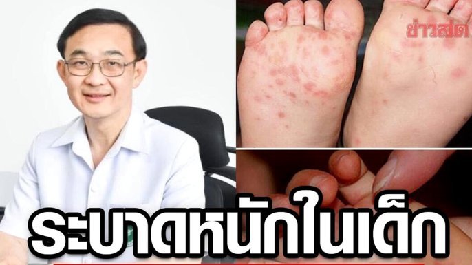 西甲AI裁判探索，特瓦斯称与老佛爷理念冲突